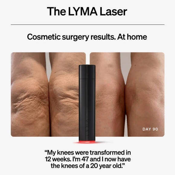 Lyma Laser (US red version); everything included! - Picture 7 of 11